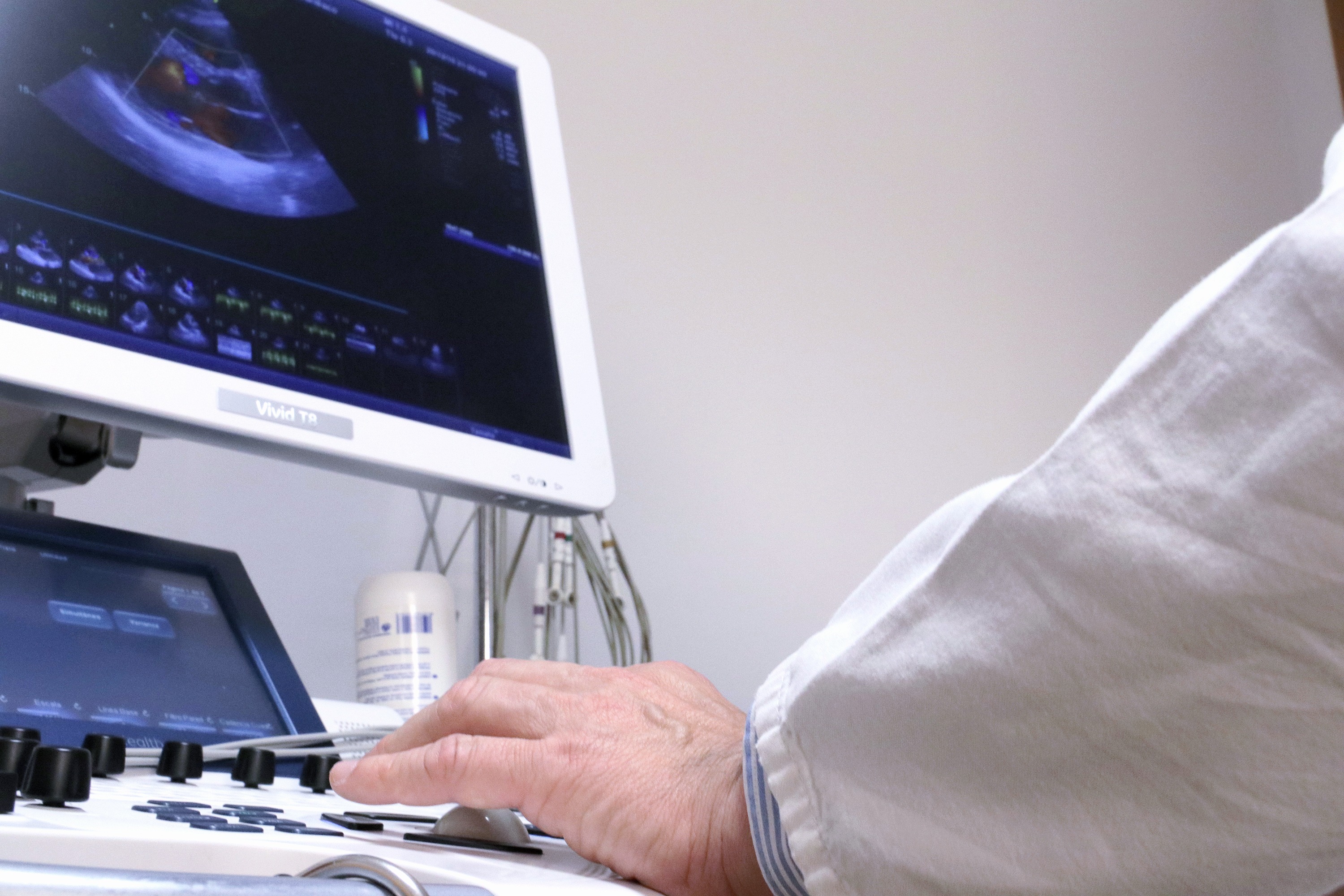 Ecocardiografía Doppler Color – Vivid TR